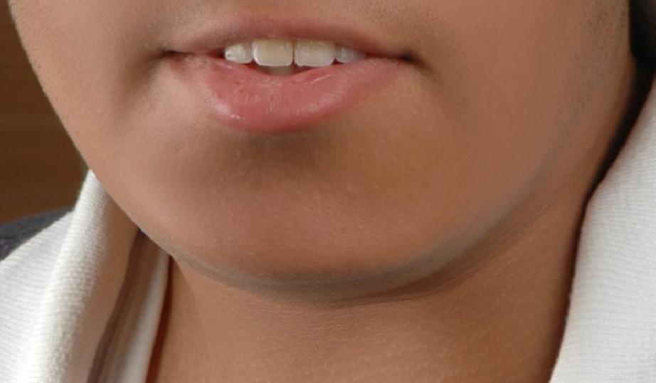Chin.JPG