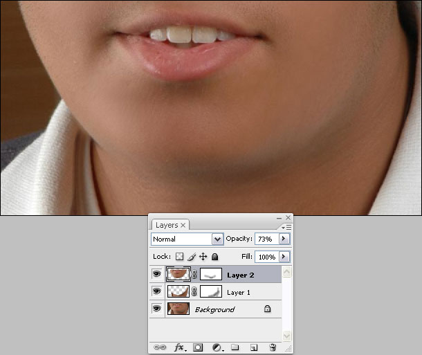 chin.jpg