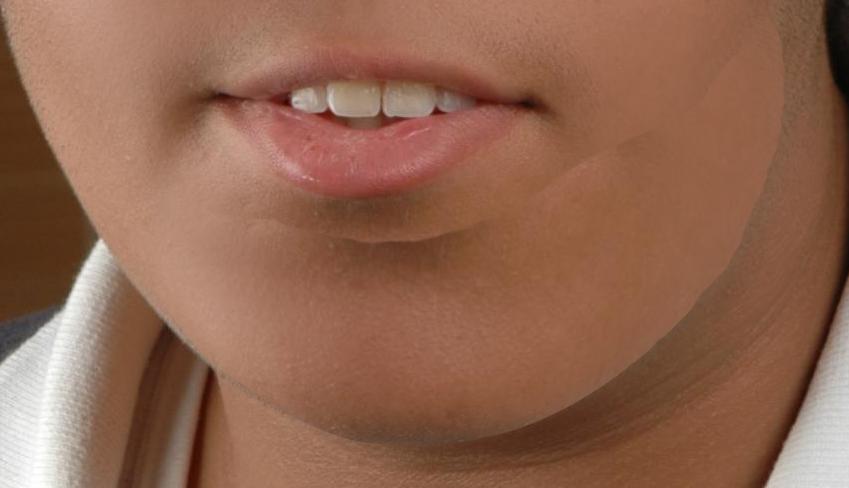 Chin.JPG